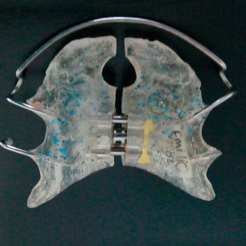 Tratamiento Temprano Ortopedia Cali