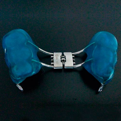 Tratamiento Temprano Ortopedia Cali