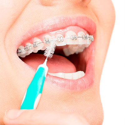 Higiene oral en Cali