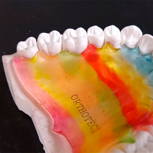 Ortodoncia tratamiento temprano Cali